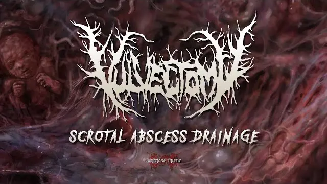 sddefault